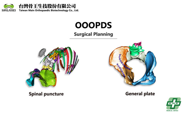 台灣骨王 OOOPDS 取得 TFDA CLASS II 醫療用手術規劃軟體