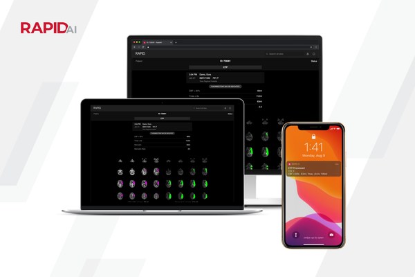 RapidAI中風成像軟體可以加速醫師診斷、簡化臨床工作流程，提高台灣中風患者照護品質