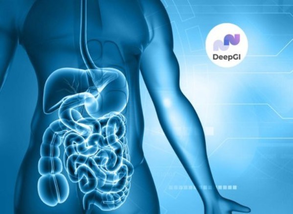 DeepGI——用於精確檢測結直腸息肉的泰國創新產品
